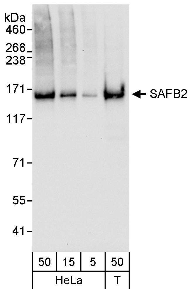 SAFB2 Antibody in Western Blot (WB)