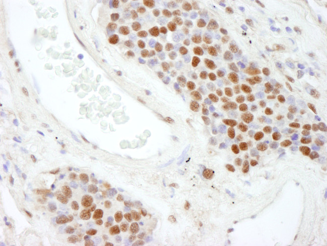 SAFB2 Antibody in Immunohistochemistry (Paraffin) (IHC (P))