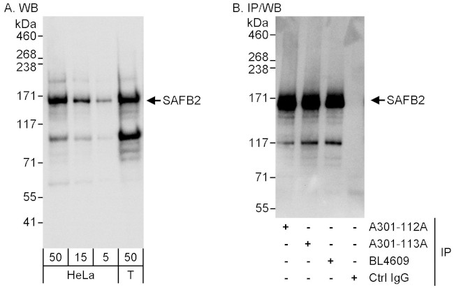 SAFB2 Antibody in Western Blot (WB)