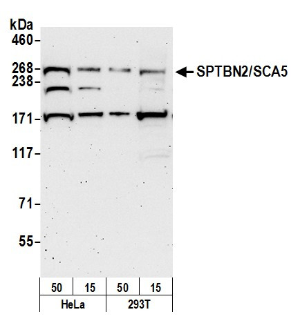 SPTBN2/SCA5 Antibody in Western Blot (WB)