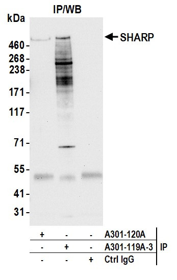 SHARP Antibody in Immunoprecipitation (IP)