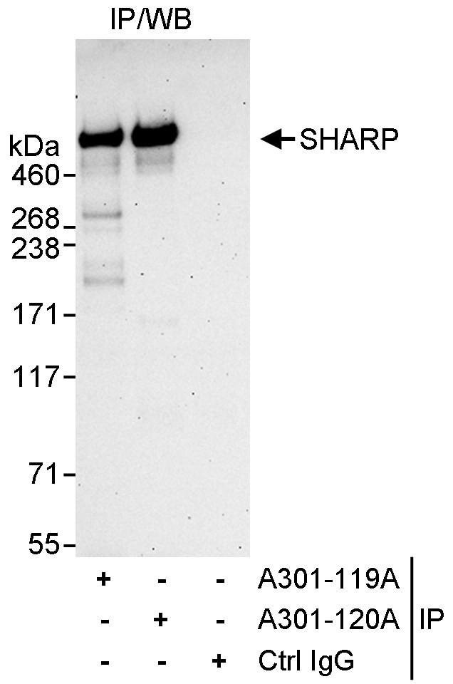 SHARP Antibody in Immunoprecipitation (IP)