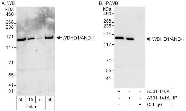 WDHD1/AND-1 Antibody in Western Blot (WB)