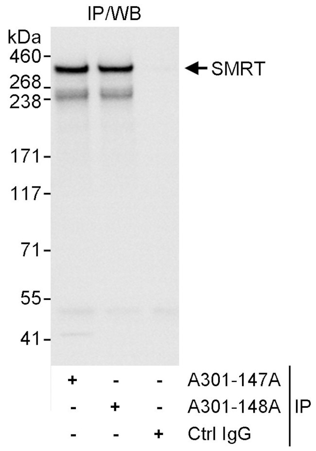 SMRT Antibody in Immunoprecipitation (IP)