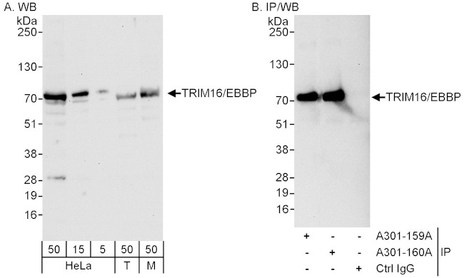 TRIM16/EBBP Antibody in Western Blot (WB)