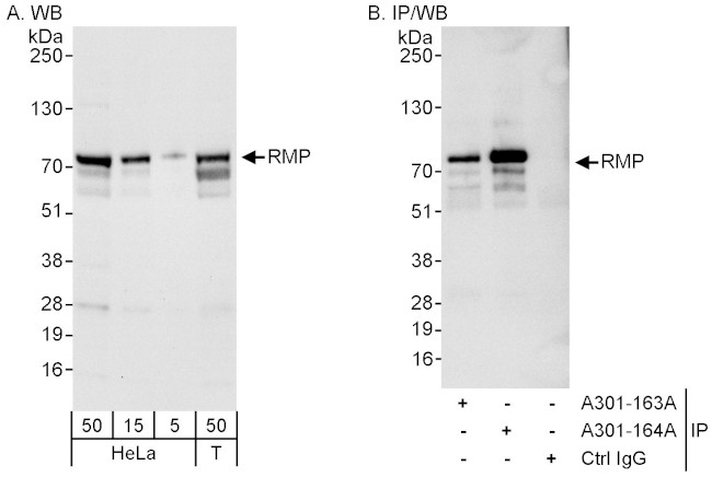 RMP Antibody in Western Blot (WB)