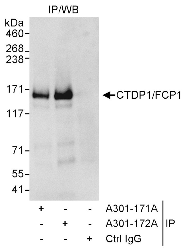 CTDP1/FCP1 Antibody in Immunoprecipitation (IP)