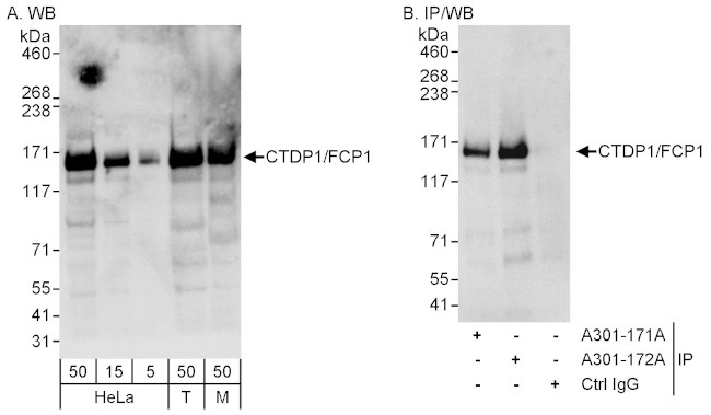 CTDP1/FCP1 Antibody in Western Blot (WB)