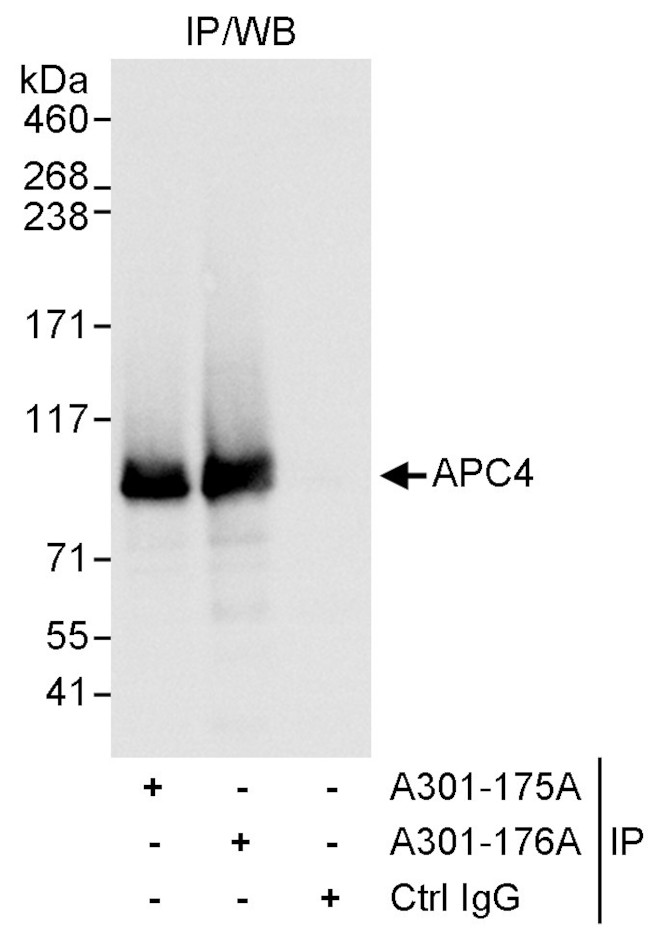 APC4 Antibody in Immunoprecipitation (IP)