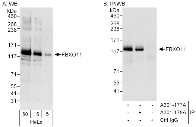 FBXO11 Antibody in Western Blot (WB)
