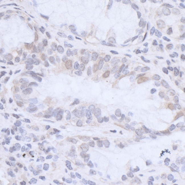 HMGN3 Antibody in Immunohistochemistry (Paraffin) (IHC (P))