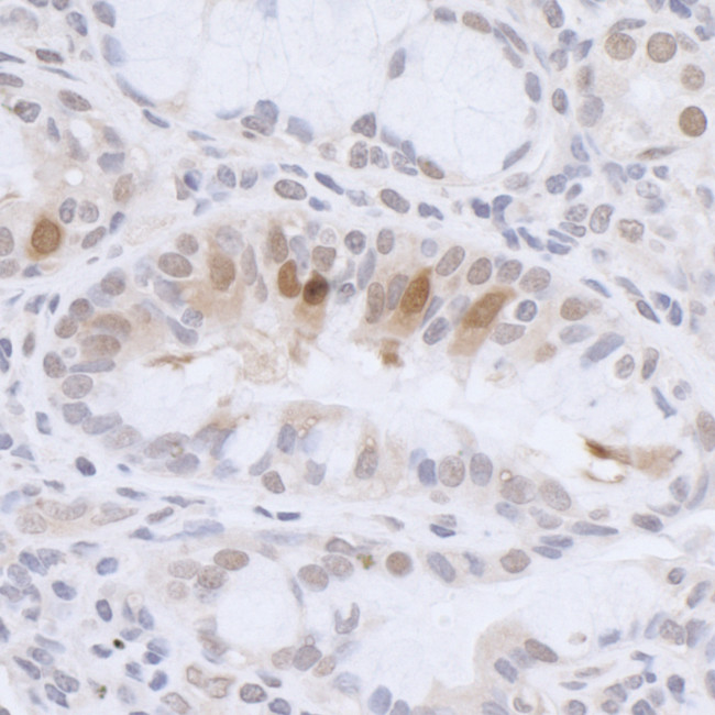 HMGN3 Antibody in Immunohistochemistry (Paraffin) (IHC (P))