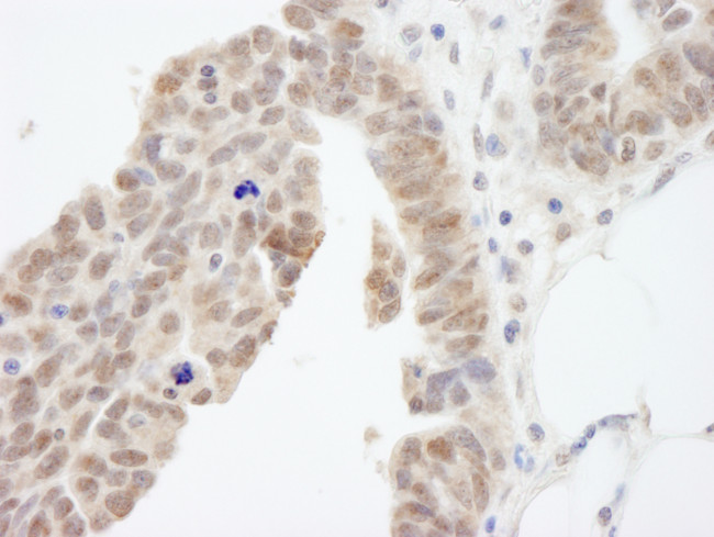 ABI1 Antibody in Immunohistochemistry (Paraffin) (IHC (P))