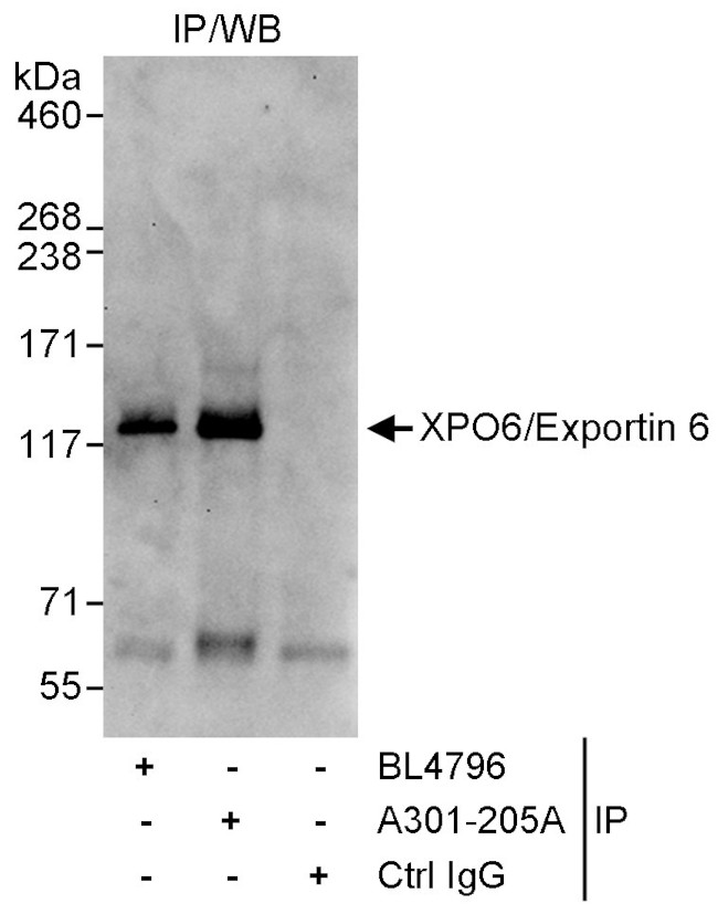 XPO6/Exportin 6 Antibody in Immunoprecipitation (IP)