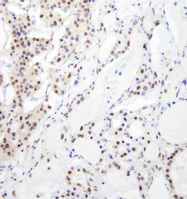 RBM26 Antibody in Immunohistochemistry (Paraffin) (IHC (P))