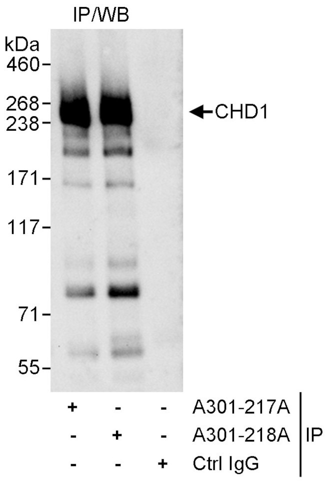CHD1 Antibody in Immunoprecipitation (IP)