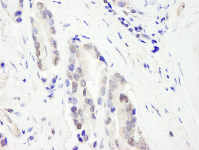 CHD3 Antibody in Immunohistochemistry (Paraffin) (IHC (P))