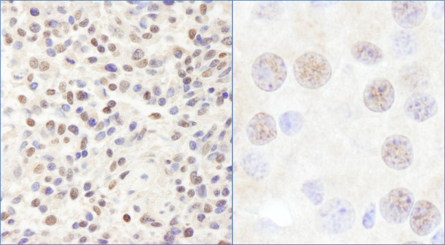 CHD3 Antibody in Immunohistochemistry (Paraffin) (IHC (P))