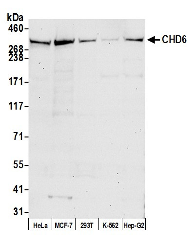 CHD6 Antibody in Western Blot (WB)