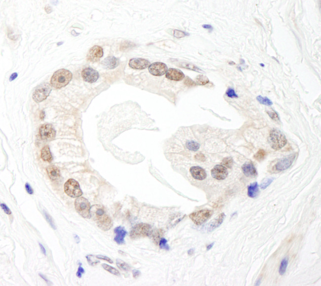 BRF1 Antibody in Immunohistochemistry (Paraffin) (IHC (P))