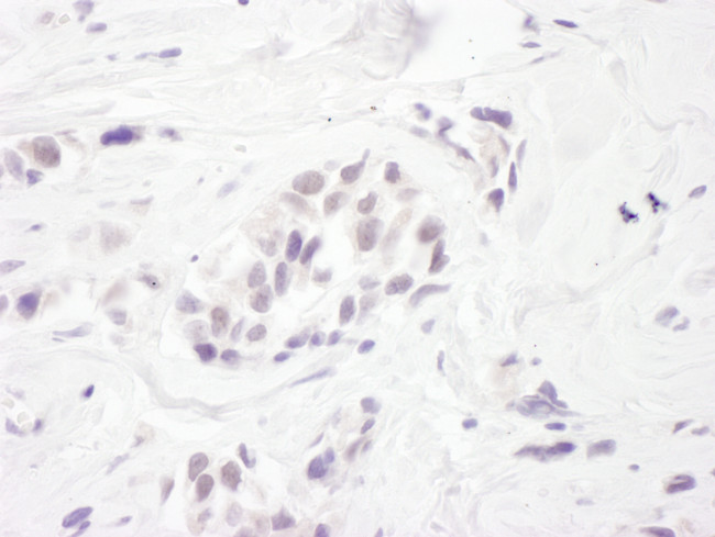 RBM27 Antibody in Immunohistochemistry (Paraffin) (IHC (P))