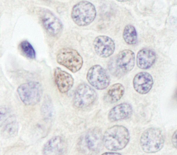 RBM27 Antibody in Immunohistochemistry (Paraffin) (IHC (P))