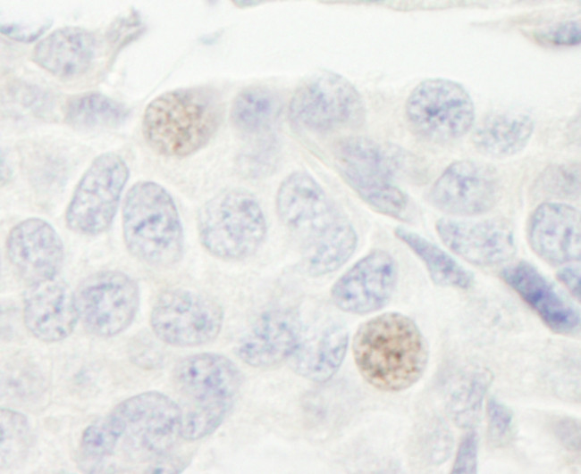 GTF3C2/TFIIIC110 Antibody in Immunohistochemistry (Paraffin) (IHC (P))