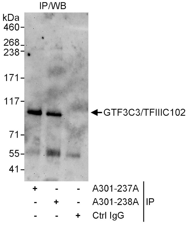 GTF3C3/TFIIIC102 Antibody in Immunoprecipitation (IP)