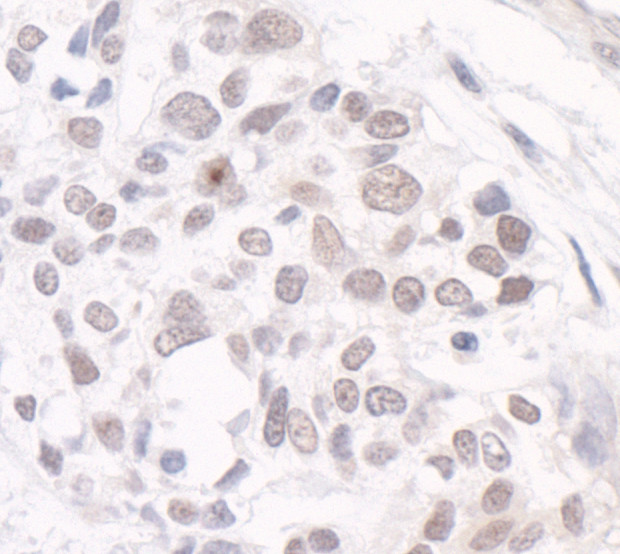 GTF3C3/TFIIIC102 Antibody in Immunohistochemistry (Paraffin) (IHC (P))