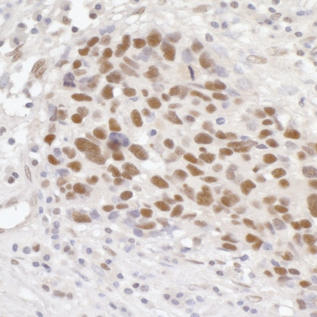 GTF3C5/TFIIIC63 Antibody in Immunohistochemistry (Paraffin) (IHC (P))