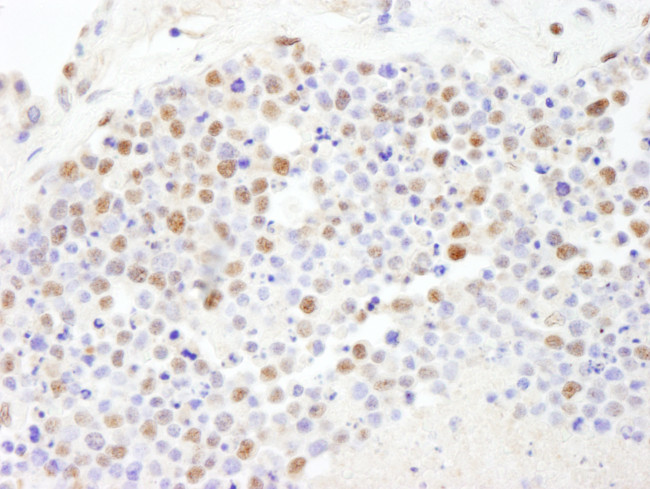 PolD3/p66 Antibody in Immunohistochemistry (Paraffin) (IHC (P))