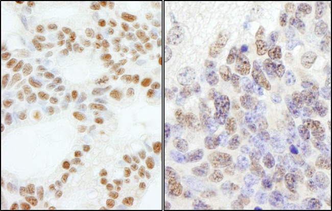 PolE3/p17 Antibody in Immunohistochemistry (Paraffin) (IHC (P))