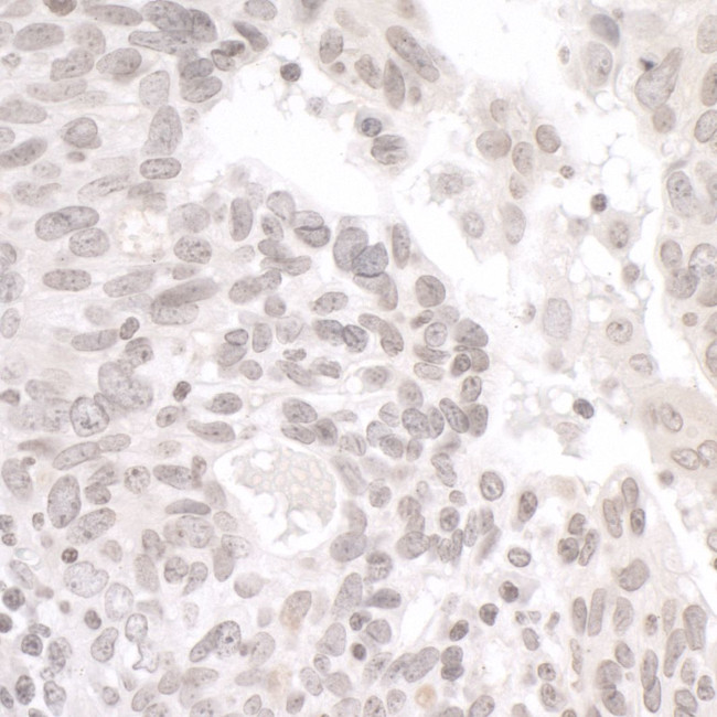 PALB2 Antibody in Immunohistochemistry (Paraffin) (IHC (P))