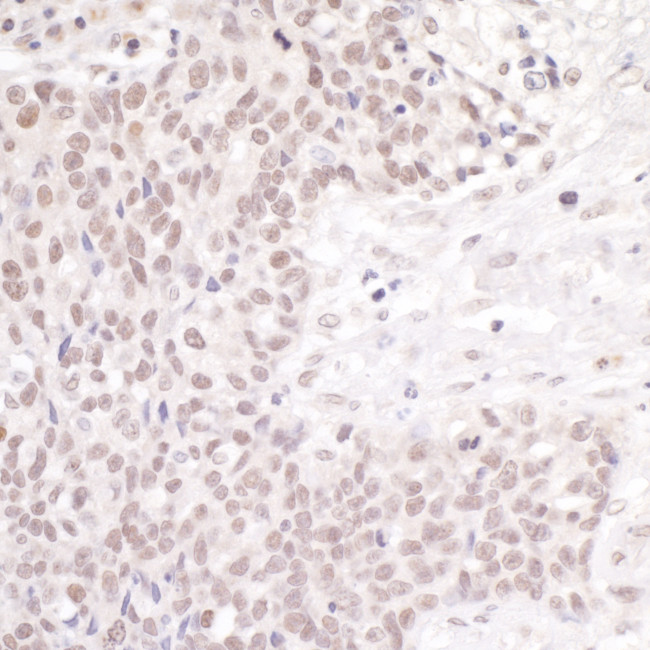 CSTF50 Antibody in Immunohistochemistry (Paraffin) (IHC (P))