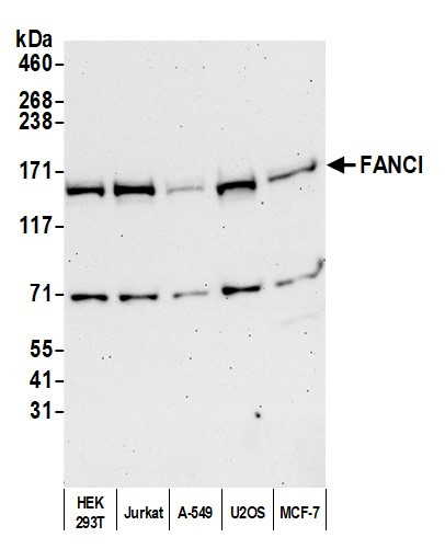 FANCI Antibody in Western Blot (WB)