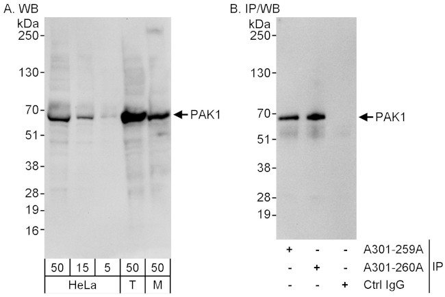 PAK1 Antibody in Western Blot (WB)