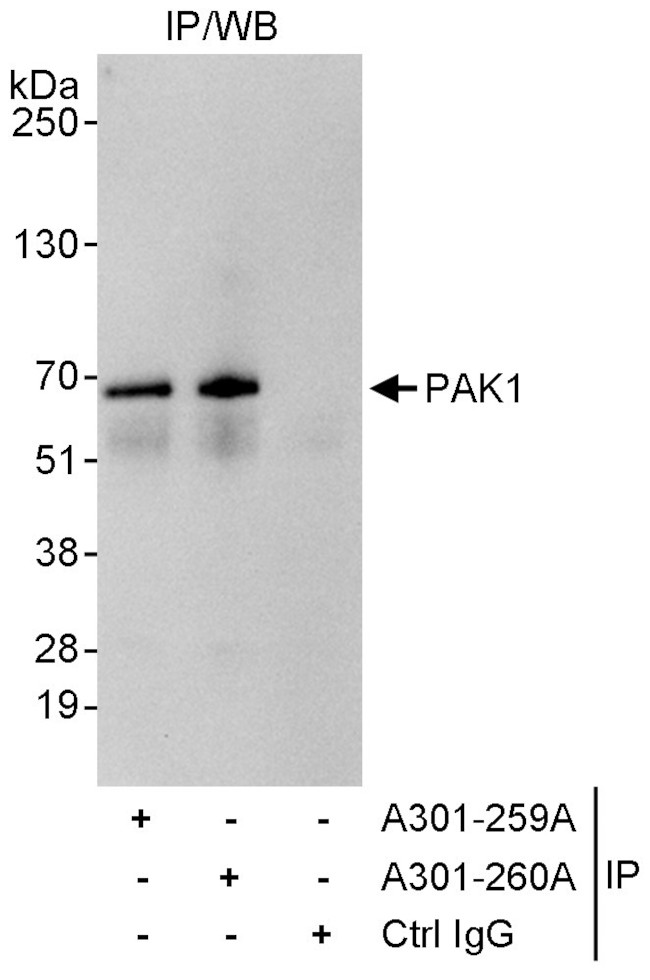 PAK1 Antibody in Immunoprecipitation (IP)