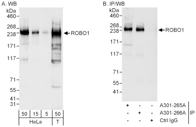 ROBO1 Antibody in Western Blot (WB)