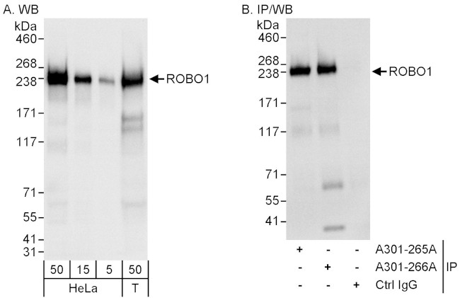 ROBO1 Antibody in Western Blot (WB)