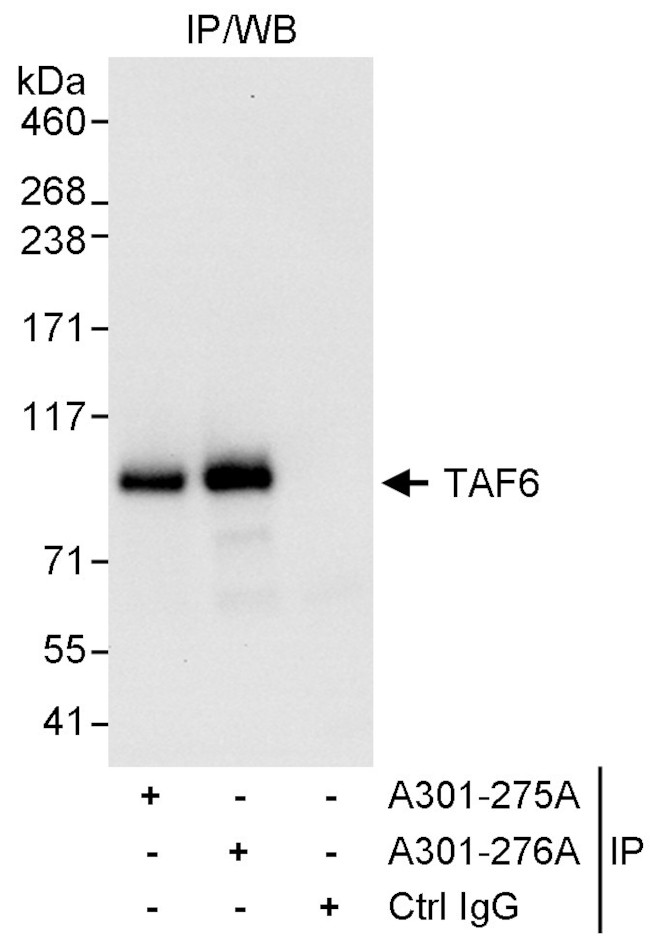 TAF6 Antibody in Immunoprecipitation (IP)