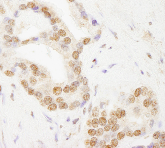 TAF6 Antibody in Immunohistochemistry (Paraffin) (IHC (P))