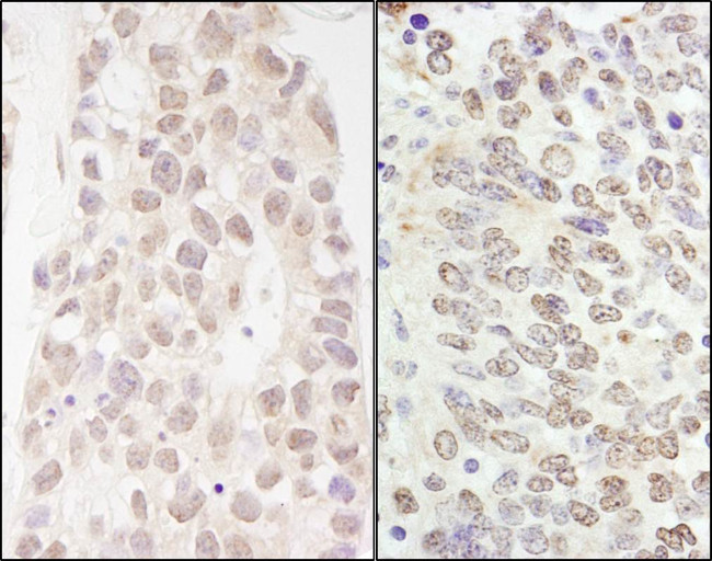 p66beta/GATAD2B Antibody in Immunohistochemistry (Paraffin) (IHC (P))