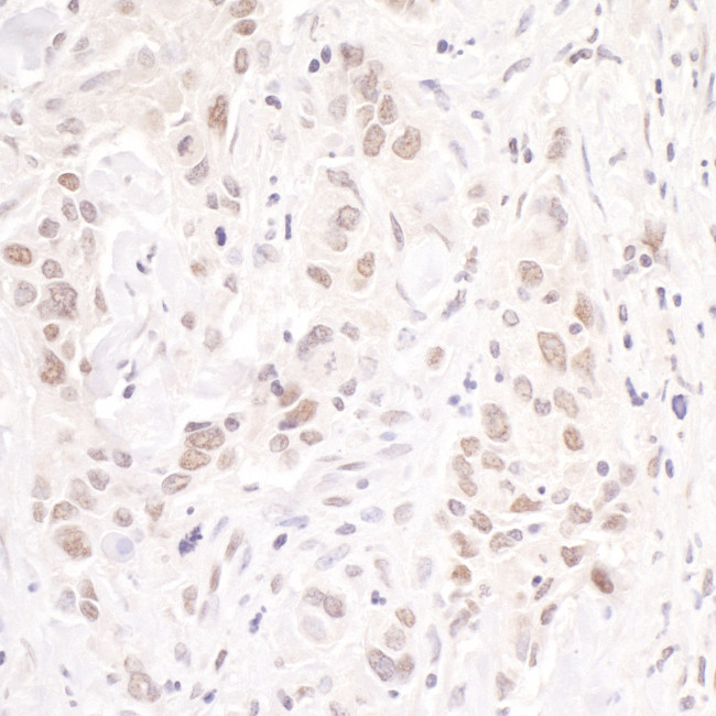 p66beta/GATAD2B Antibody in Immunohistochemistry (Paraffin) (IHC (P))