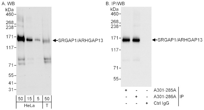 SRGAP1/ARHGAP13 Antibody in Western Blot (WB)