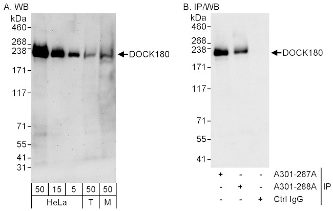 DOCK180 Antibody in Western Blot (WB)