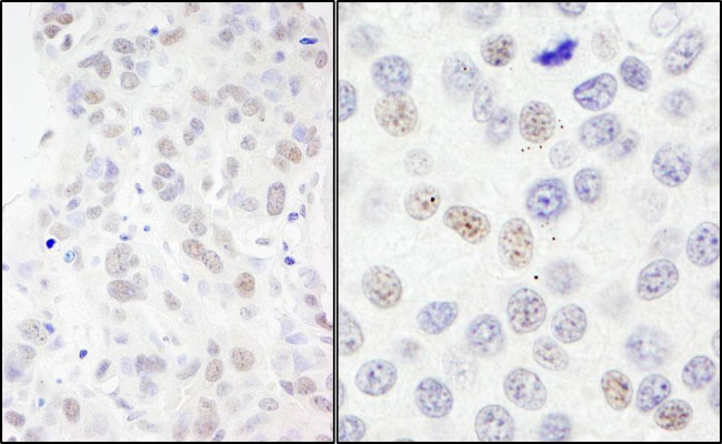 NBS1 Antibody in Immunohistochemistry (Paraffin) (IHC (P))