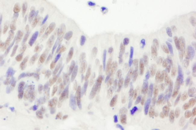 NBS1 Antibody in Immunohistochemistry (Paraffin) (IHC (P))