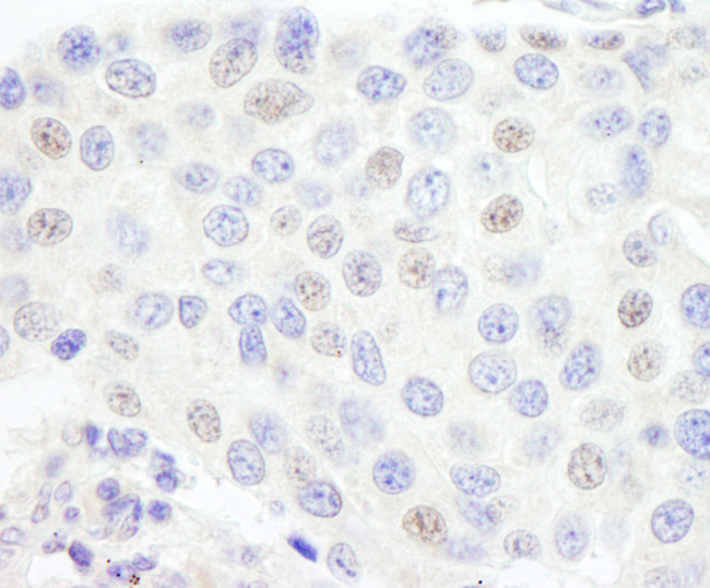 GTF3C1/TFIIIC220 Antibody in Immunohistochemistry (Paraffin) (IHC (P))
