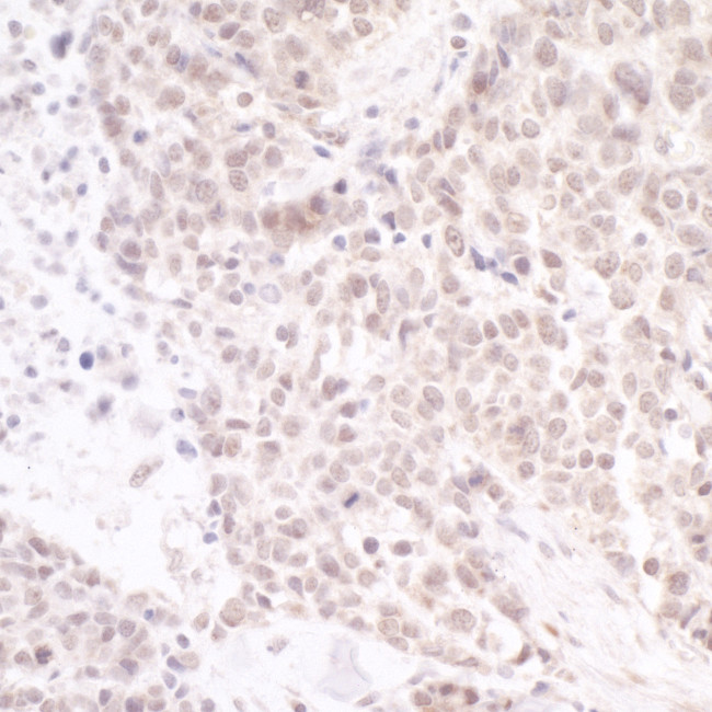 PAF49 Antibody in Immunohistochemistry (Paraffin) (IHC (P))