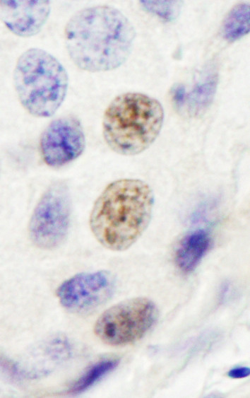 INT4 Antibody in Immunohistochemistry (Paraffin) (IHC (P))